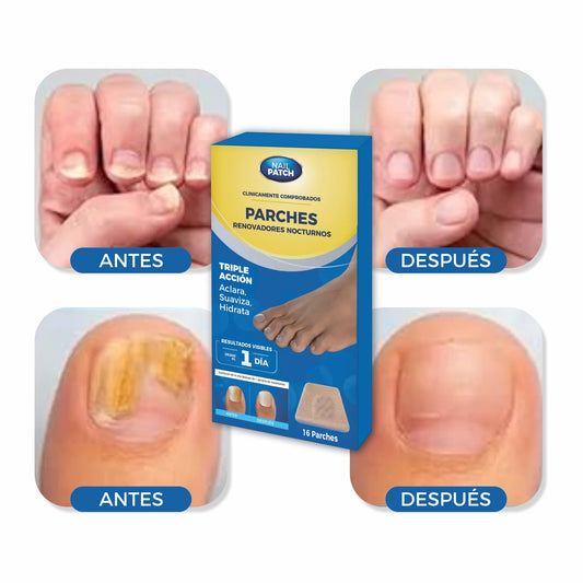 (16PCS) PARCHES PARA HONGO UÑA X1